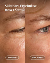 Augen-Schläfen Pads mit Aloe vera