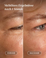 Augen-Schläfen Pads mit Ectoin