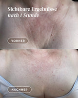 Decolleté Pad mit Ectoin