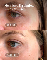 Augen-Schläfen Pads mit Hexapeptid