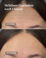 Stirn Pad mit Hexapeptid