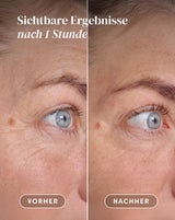 Augen-Schläfen Pads mit Hyaluron