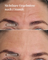 Stirn Pad mit Hyaluron