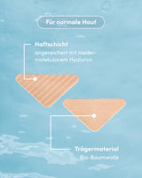 Zornesfalten Patches mit Hyaluron