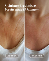 Decolleté Pad mit Vitamin C