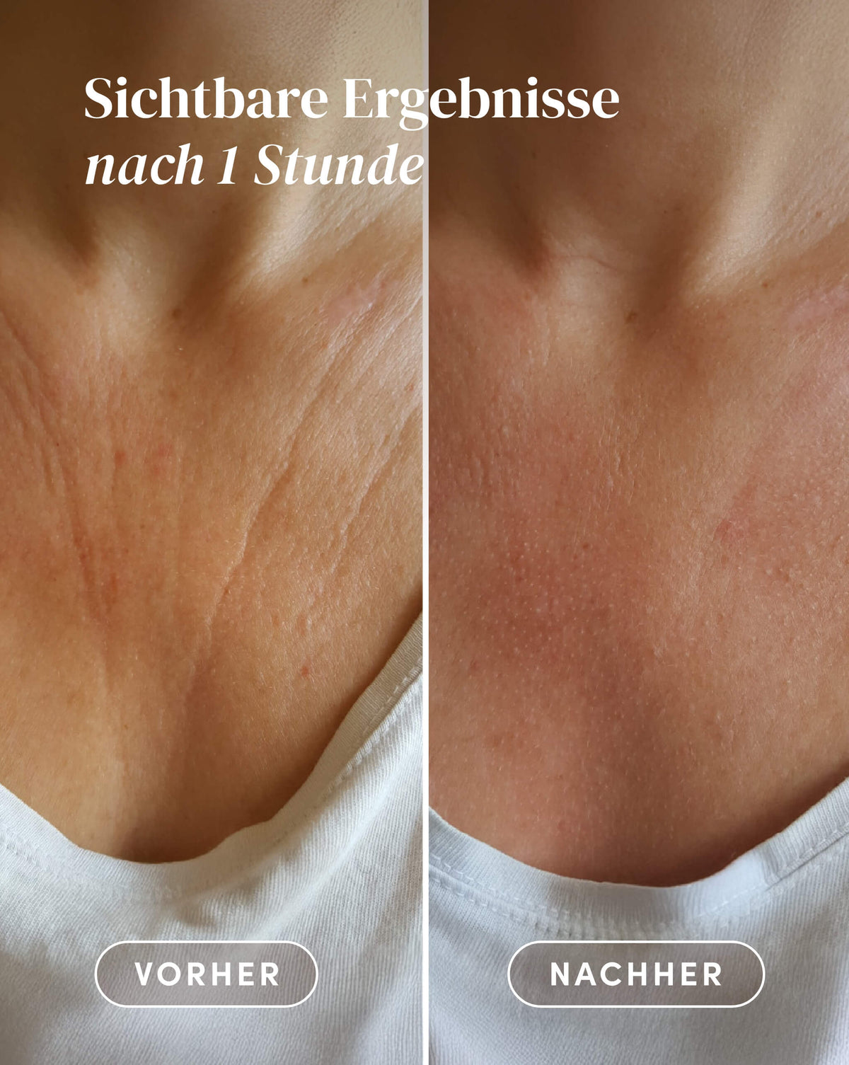 Vorher-Nachher-Ergebnis nach Anwendung des Aloe vera Dekolleté Pad