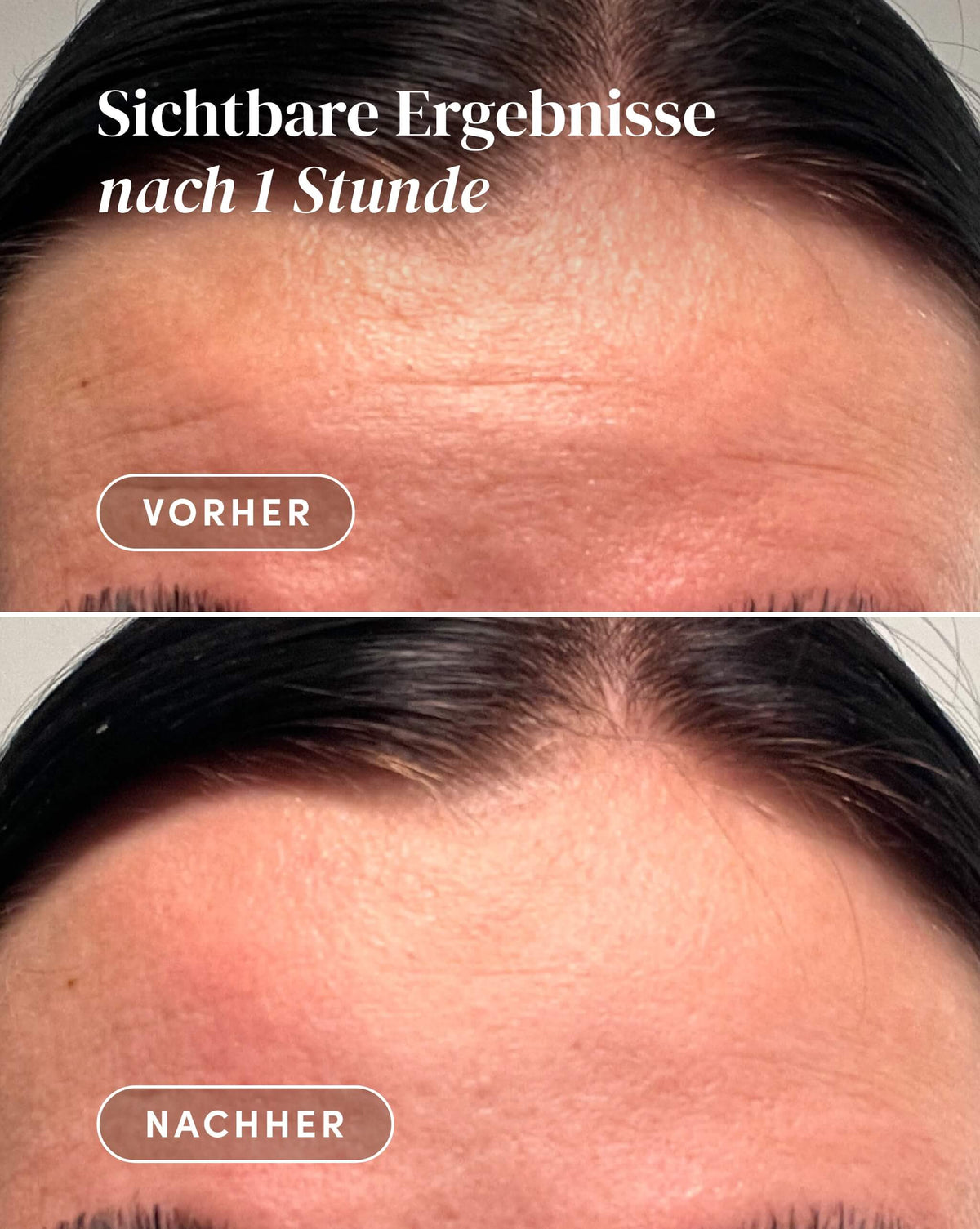 Vorher-Nachher-Ergebnis nach Anwendung des Aloe vera Stirn Pad