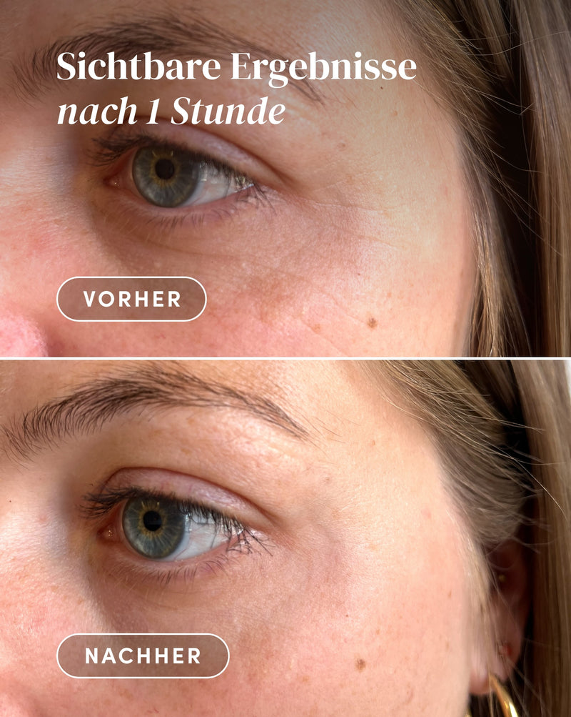Augen-Schläfen Pads mit Hexapeptid