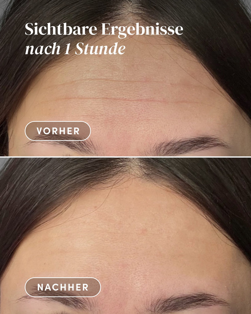 Stirn Pad mit Hexapeptid
