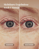 Augen Pads mit Hyaluron