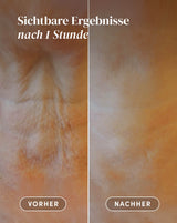 Hals Pad mit Hyaluron