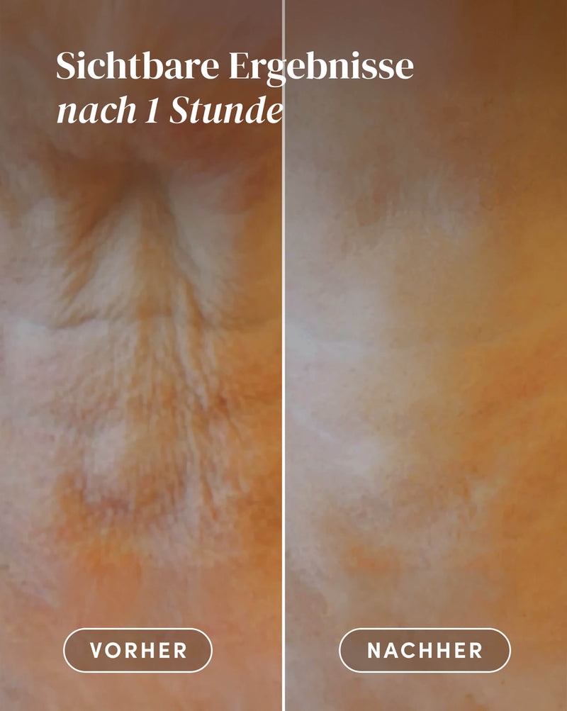 Hals Pad mit Hyaluron