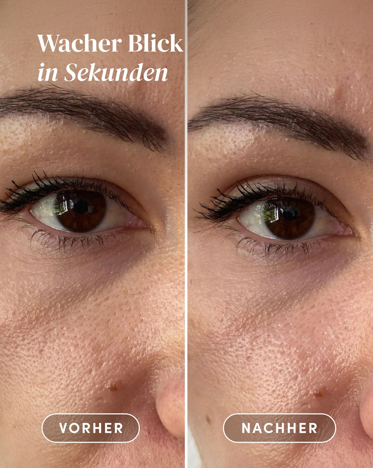 Vorher-Nachher-Ergebnis nach Anwendung der Schlupflider Tapes