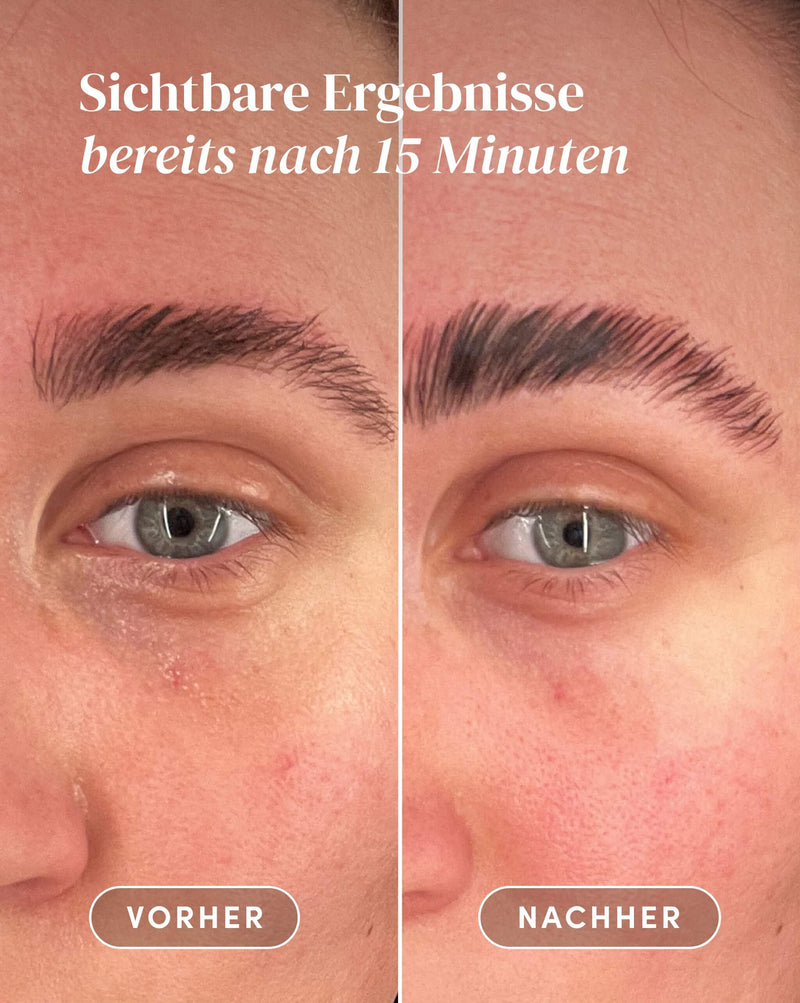 Augen Pads mit Vitamin C