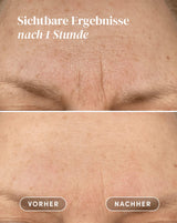 Stirn Pad mit Vitamin C