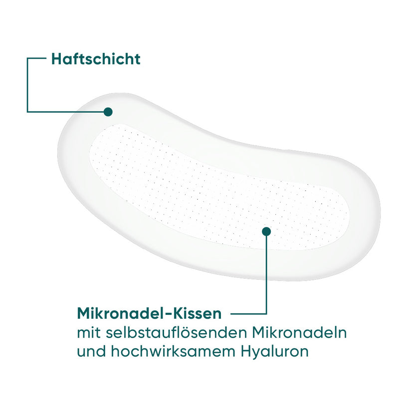 Microneedle Patches